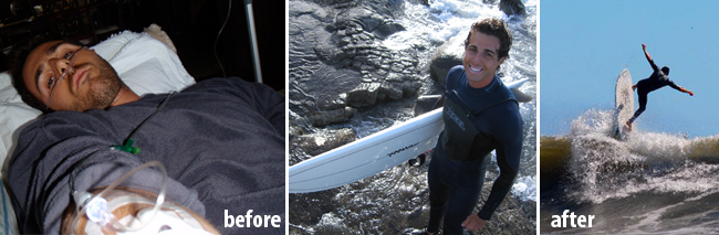 How I Cured My Fibromyalgia